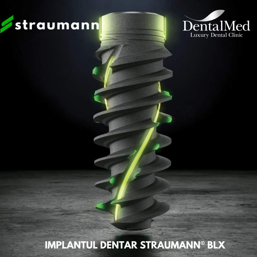 Implant Straumann BLX