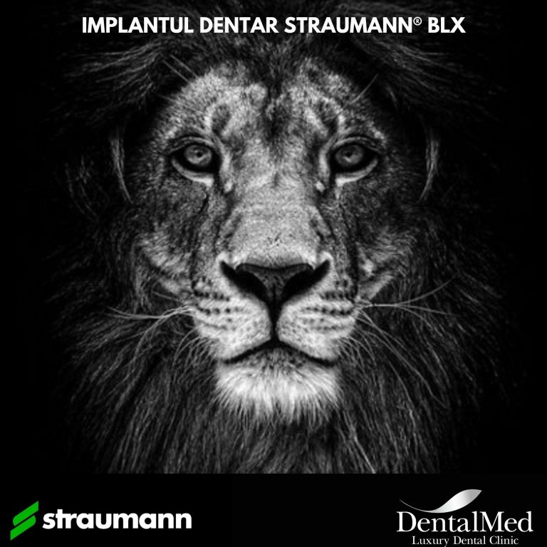 Implant dentar Straumann BLX