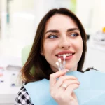 dezavantajele fatetelor dentare